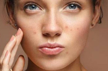 Retinoidler nedir? Retinoidler neden kullanılır?